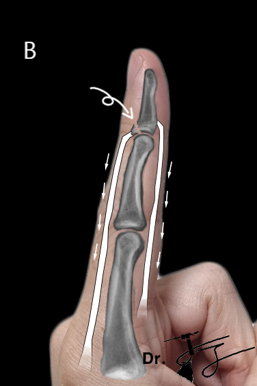 De-identified clinical image