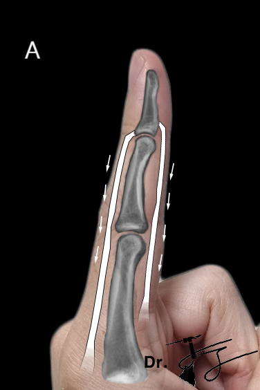 De-identified clinical image