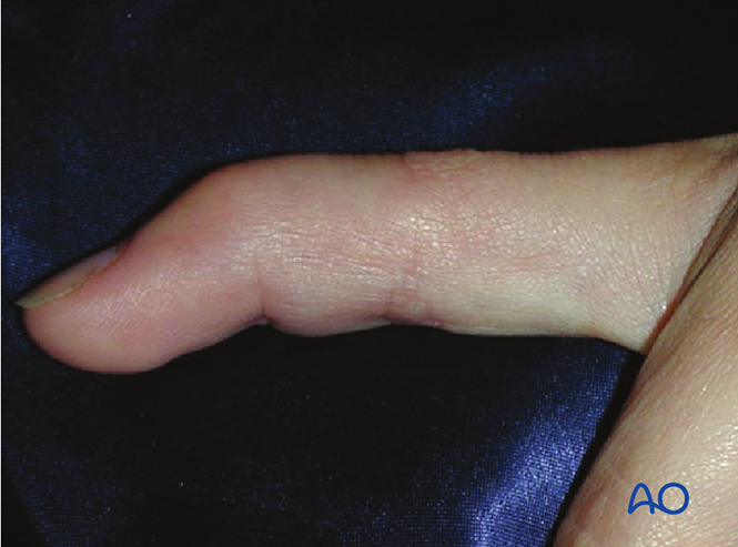 De-identified clinical image