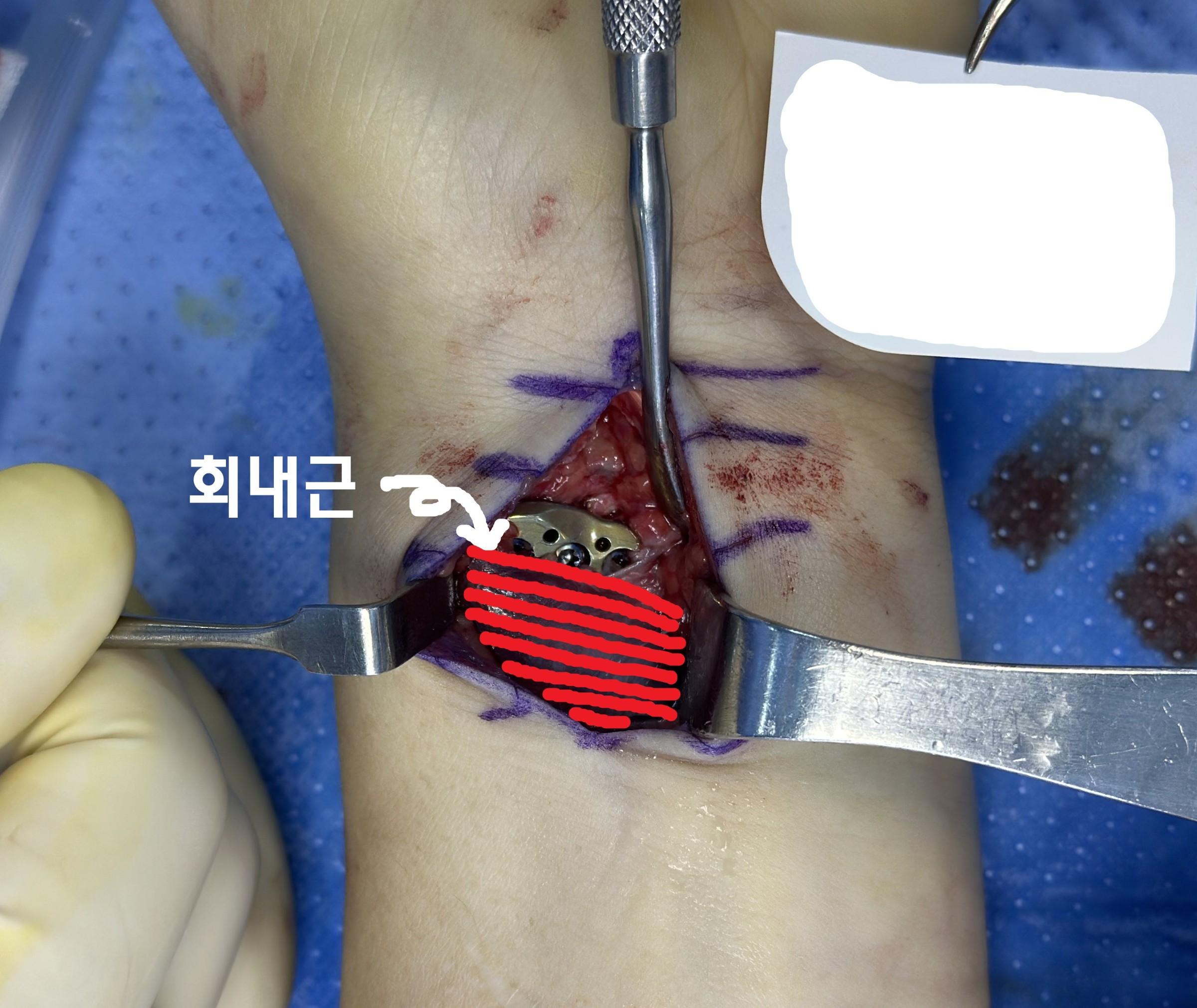 비교 후