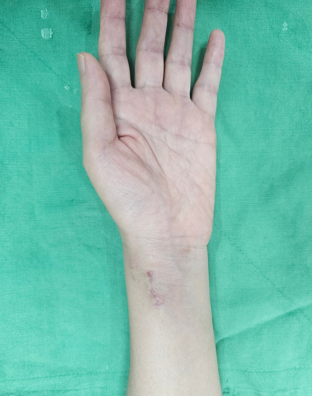 De-identified clinical image