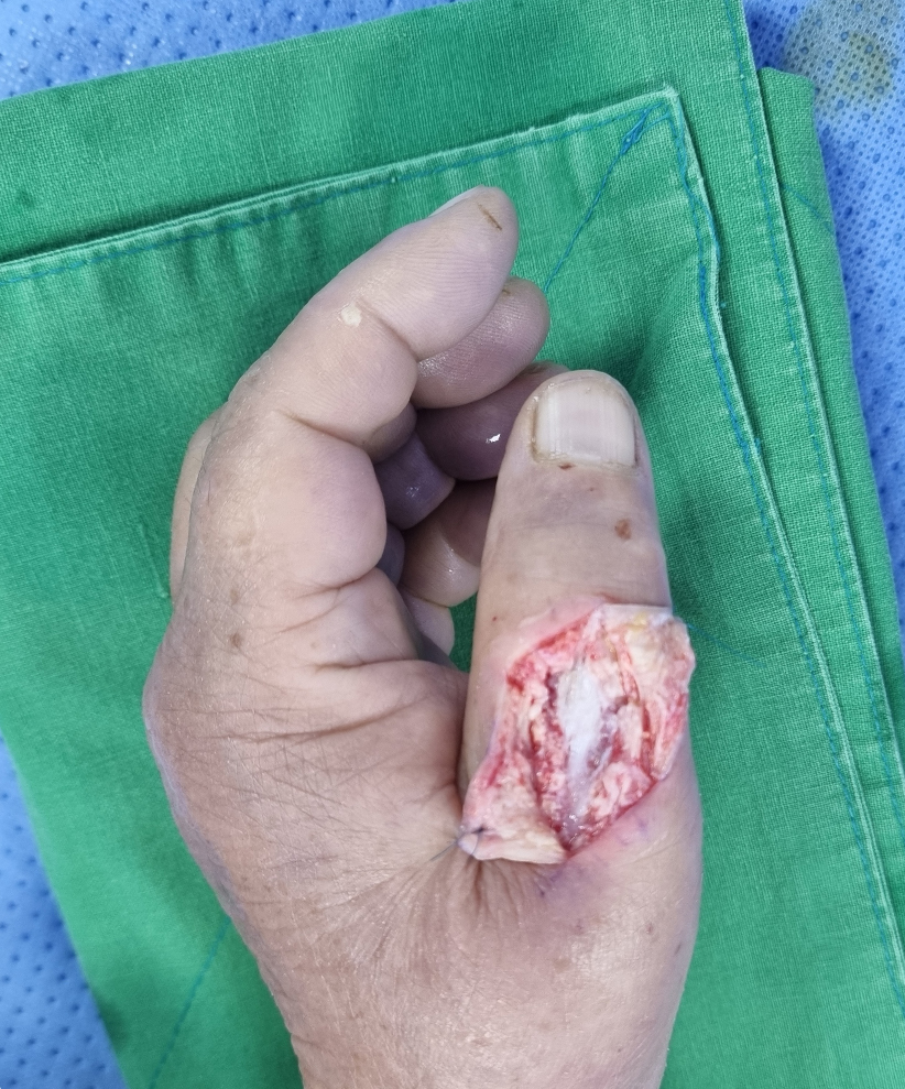 De-identified clinical image