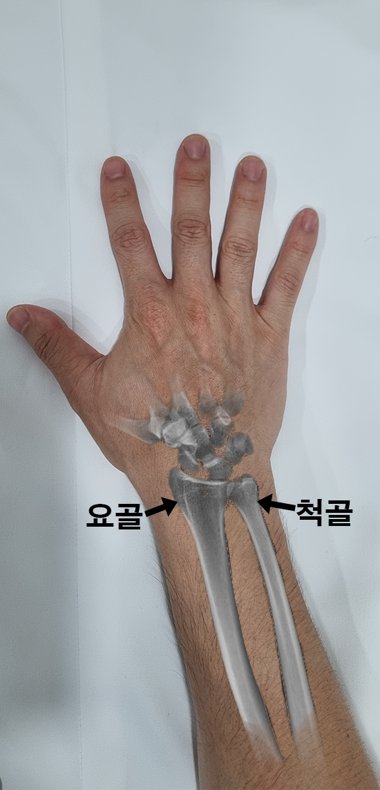 De-identified clinical image
