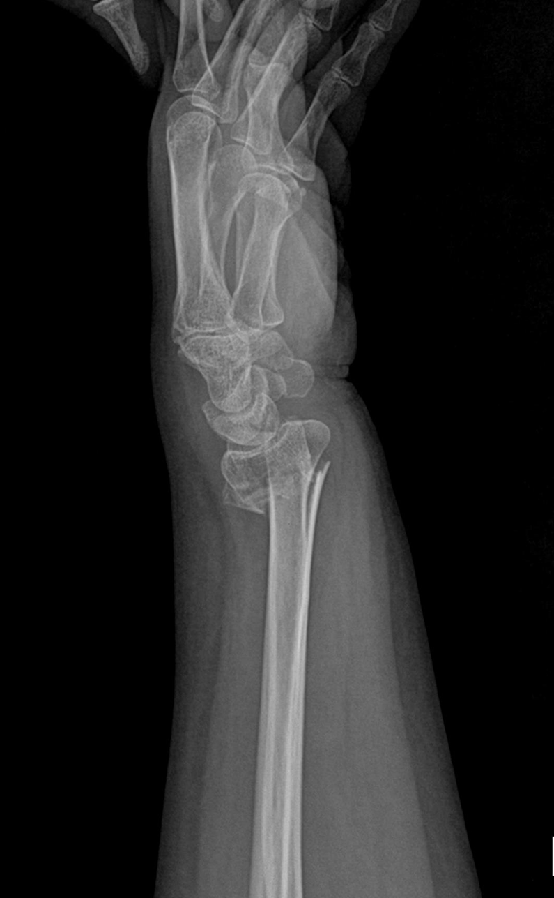 De-identified clinical image