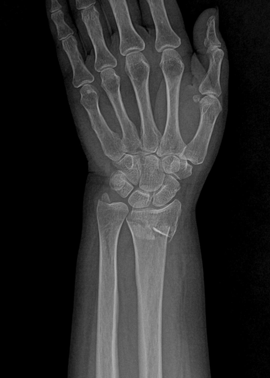 De-identified clinical image