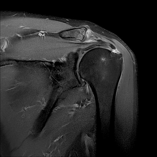 MRI