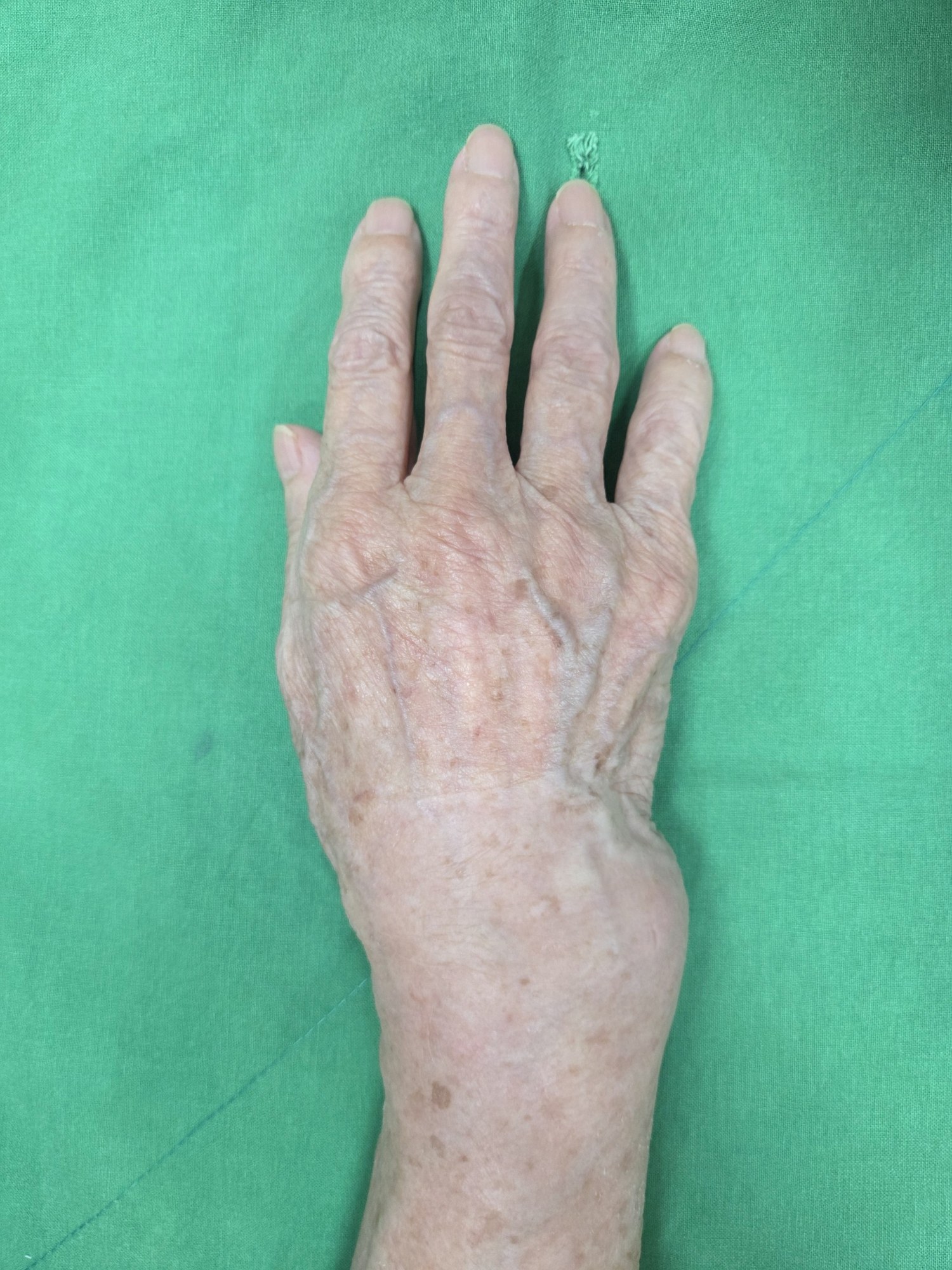 De-identified clinical image