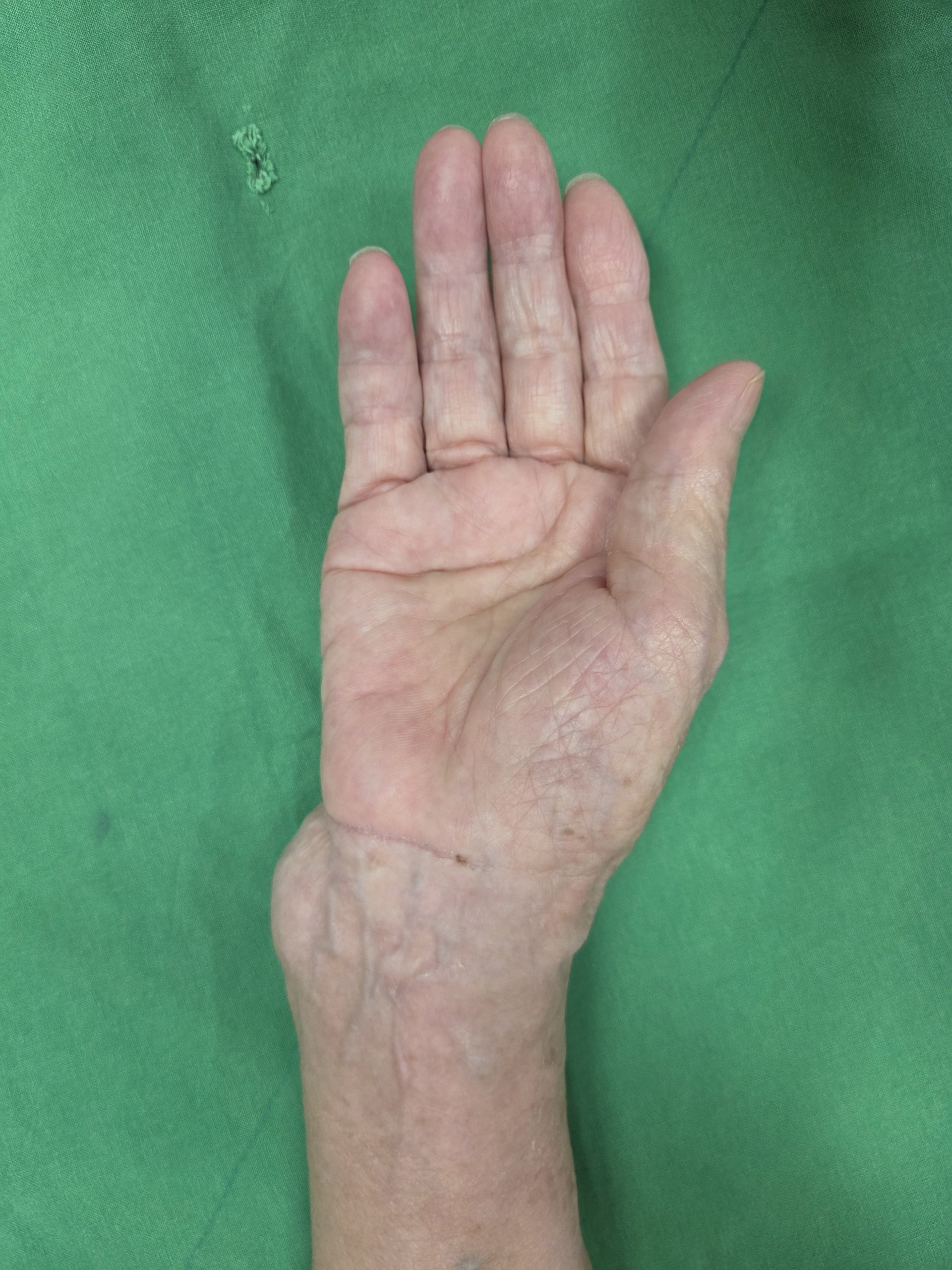 De-identified clinical image