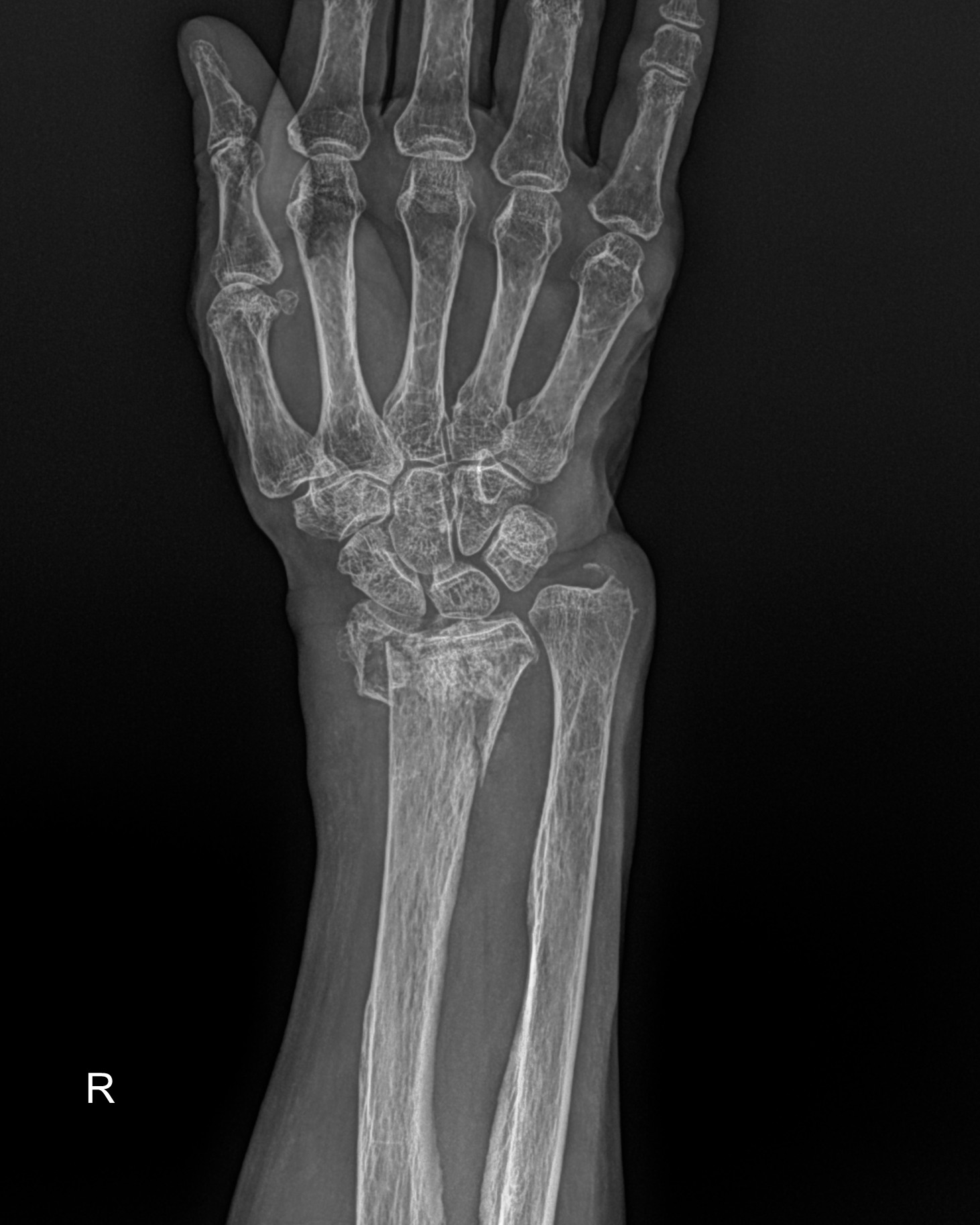 내원 당시 x-ray