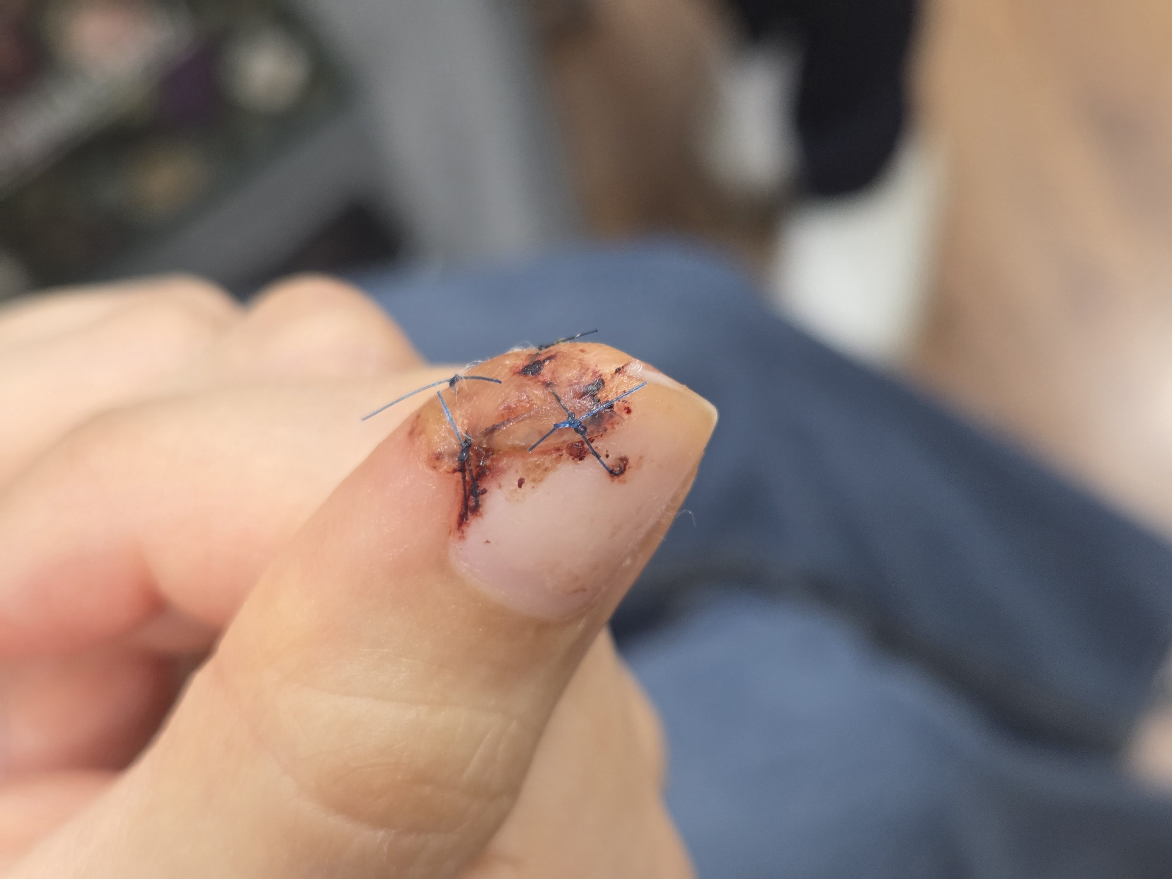 De-identified clinical image