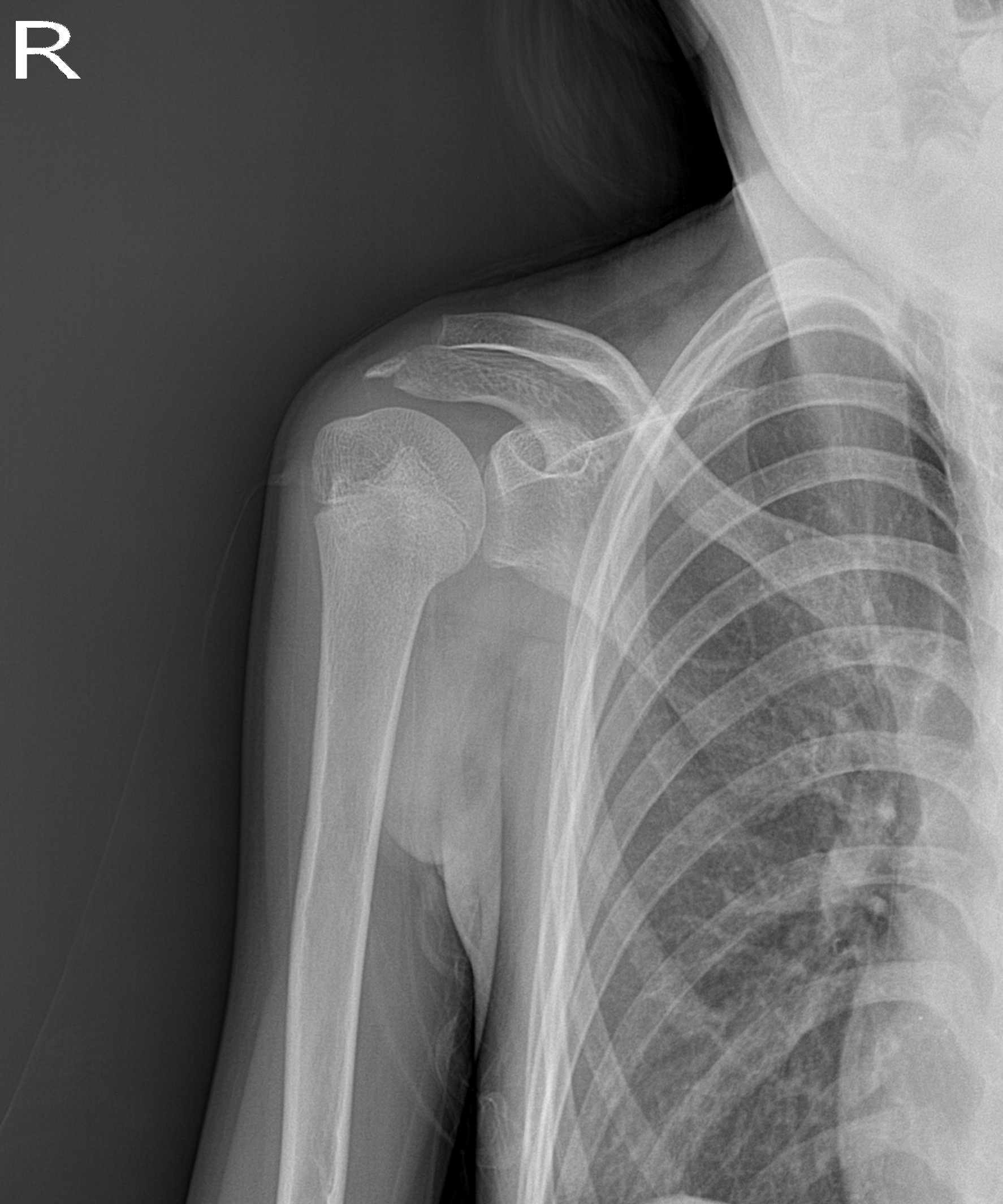 정상측 x-ray